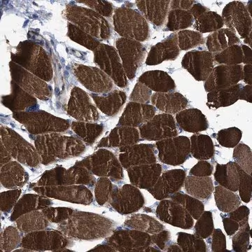 Anti-USP29 antibody produced in rabbit, 1 X 100 µL (HPA021064-100UL)