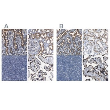 Anti-ACADVL antibody produced in rabbit, 1 X 100 µL (HPA020595-100UL)