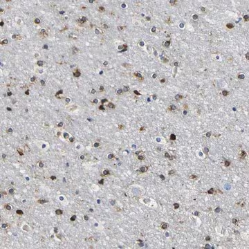 Anti-DUSP8 antibody produced in rabbit, 1 X 100 µL (HPA020071-100UL)