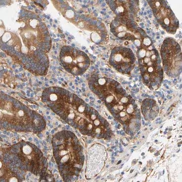 Anti-RAPH1 antibody produced in rabbit, 1 X 100 µL (HPA020027-100UL)