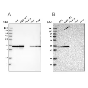 Anti-PPA1 antibody produced in rabbit, 1 X 100 µL (HPA019878-100UL)