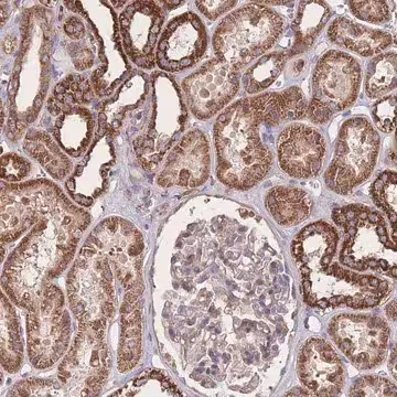 Anti-NUDT21 antibody produced in rabbit, 1 X 100 µL (HPA019863-100UL)