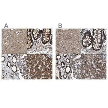 Anti-NDUFV3 antibody produced in rabbit, 1 X 100 µL (HPA019791-100UL)