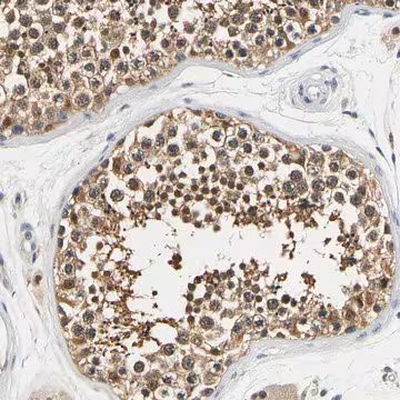 Anti-UCHL3 antibody produced in rabbit, 1 X 100 µL (HPA019678-100UL)