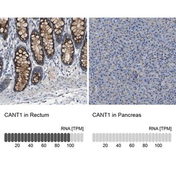 Anti-CANT1 antibody produced in rabbit, 1 X 100 µL (HPA019639-100UL)