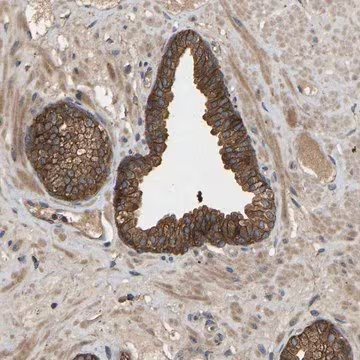 Anti-LPAR2 antibody produced in rabbit, 1 X 100 µL (HPA019616-100UL)