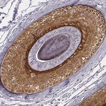 Anti-KRT75 antibody produced in rabbit, 1 X 100 µL (HPA019367-100UL)