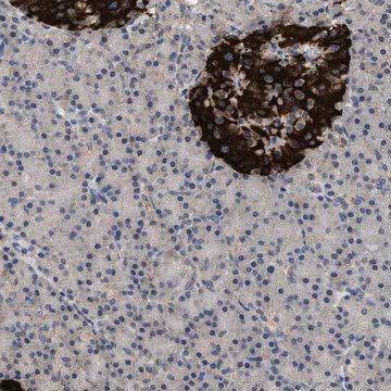 Anti-WDR31 antibody produced in rabbit, 1 X 100 µL (HPA019340-100UL)