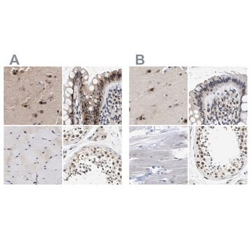 Anti-THOC1 antibody produced in rabbit, 1 X 100 µL (HPA019096-100UL)
