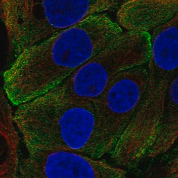 Anti-KLK7 antibody produced in rabbit, 1 X 100 µL (HPA018994-100UL)
