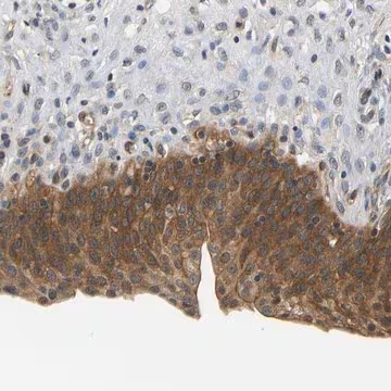 Anti-ARHGEF12 antibody produced in rabbit, 1 X 100 µL (HPA018911-100UL)