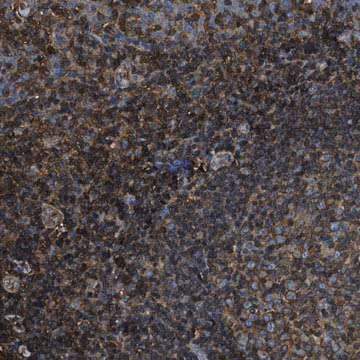 Anti-ACCS antibody produced in rabbit, 1 X 100 µL (HPA018873-100UL)