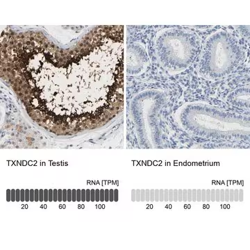 Anti-TXNDC2 antibody produced in rabbit, 1 X 100 µL (HPA018817-100UL)