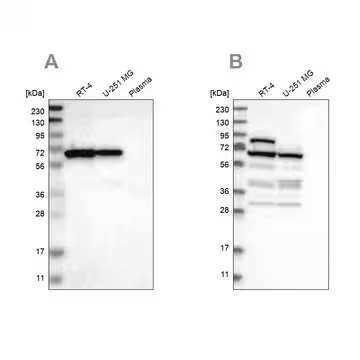Anti-NOP58 antibody produced in rabbit, 1 X 100 µL (HPA018472-100UL)