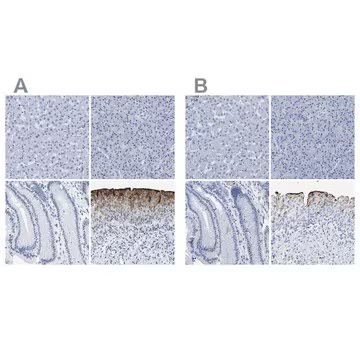 Anti-UPK3A antibody produced in rabbit, 1 X 100 µL (HPA018415-100UL)