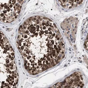 Anti-UPF3A antibody produced in rabbit, 1 X 100 µL (HPA018325-100UL)