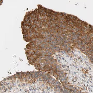 Anti-CEP57 antibody produced in rabbit, 1 X 100 µL (HPA018315-100UL)