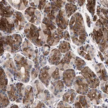 Anti-NEK7 antibody produced in rabbit, 1 X 100 µL (HPA018193-100UL)