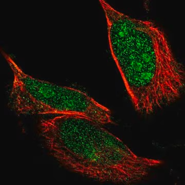 Anti-NLK antibody produced in rabbit, 1 X 100 µL (HPA018192-100UL)