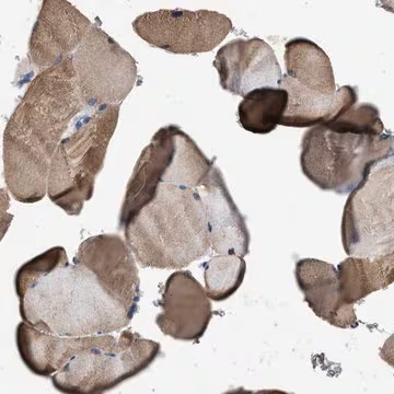 Anti-ITSN1 antibody produced in rabbit, 1 X 100 µL (HPA018007-100UL)