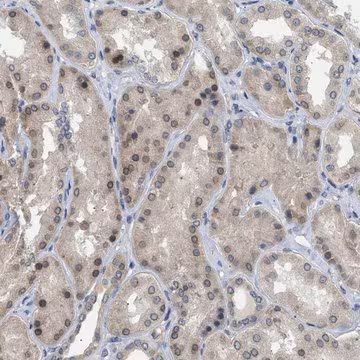 Anti-NUP93 antibody produced in rabbit, 1 X 100 µL (HPA017937-100UL)