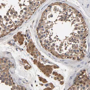 Anti-STK32C antibody produced in rabbit, 1 X 100 µL (HPA017894-100UL)