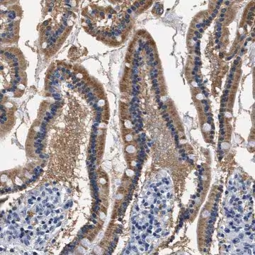 Anti-HS3ST2 antibody produced in rabbit, 1 X 100 µL (HPA017736-100UL)