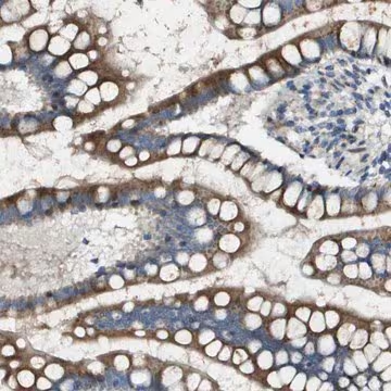 Anti-MGAT3 antibody produced in rabbit, 1 X 100 µL (HPA017598-100UL)