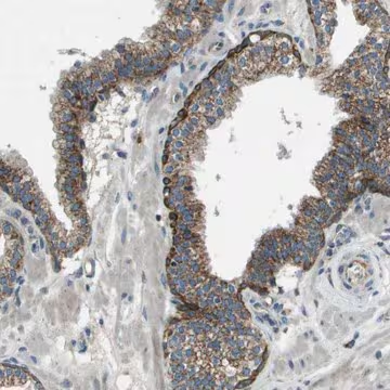 Anti-MIGA1 antibody produced in rabbit, 1 X 100 µL (HPA017589-100UL)