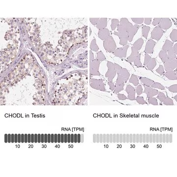 Anti-CHODL antibody produced in rabbit, 1 X 100 µL (HPA017282-100UL)