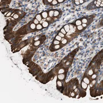 Anti-UBA5 antibody produced in rabbit, 1 X 100 µL (HPA017235-100UL)