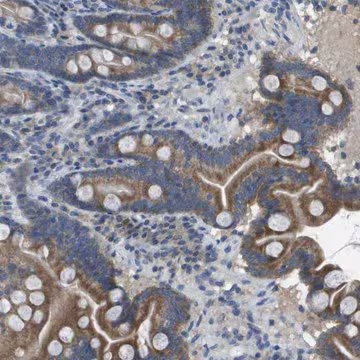 Anti-CLCA4 antibody produced in rabbit, 1 X 100 µL (HPA017045-100UL)