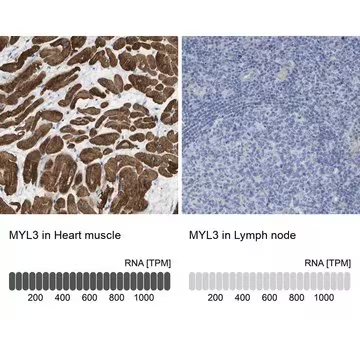 Anti-MYL3 antibody produced in rabbit, 1 X 100 µL (HPA016564-100UL)
