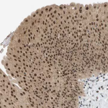 Anti-ARID1B antibody produced in rabbit, 1 X 100 µL (HPA016511-100UL)