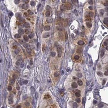 Anti-CHST8 antibody produced in rabbit, 1 X 100 µL (HPA016004-100UL)