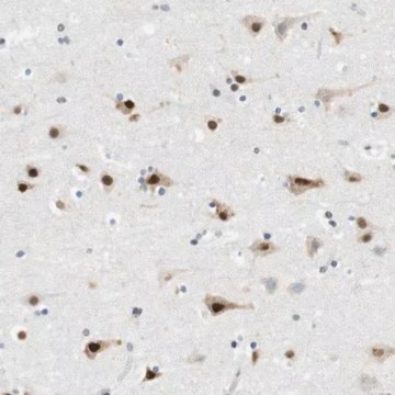Anti-RNF38 antibody produced in rabbit, 1 X 100 µL (HPA015853-100UL)