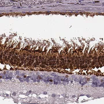 Anti-RCVRN antibody produced in rabbit, 100 µL (HPA015783-100UL)