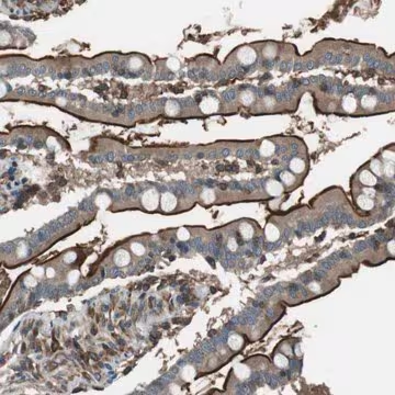 Anti-GPR161 antibody produced in rabbit, 1 X 100 µL (HPA015576-100UL)