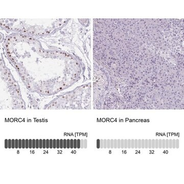 Anti-MORC4 antibody produced in rabbit, 1 X 100 µL (HPA015547-100UL)
