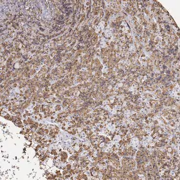 Anti-NEUROD4 antibody produced in rabbit, 100 µL (HPA015545-100UL)