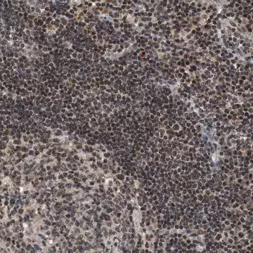 Anti-ZBTB11 antibody produced in rabbit, 1 X 100 µL (HPA015328-100UL)