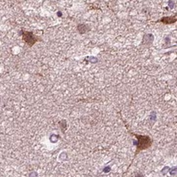 Anti-PRLH antibody produced in rabbit, 100 µL (HPA014976-100UL)