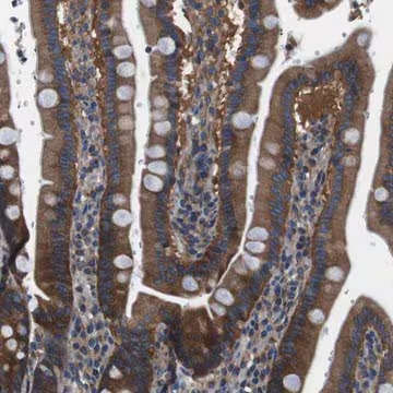 Anti-DENND4C antibody produced in rabbit, 1 X 100 µL (HPA014917-100UL)