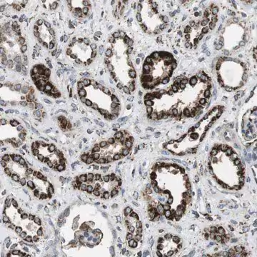 Anti-KCNE3 antibody produced in rabbit, 1 X 100 µL (HPA014849-100UL)