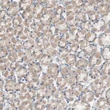 Anti-ZDHHC20 antibody produced in rabbit, 1 X 100 µL (HPA014702-100UL)