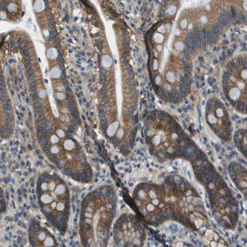 Anti-TMEM51 antibody produced in rabbit, 1 X 100 µL (HPA014547-100UL)