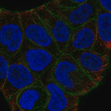 Anti-SLITRK6 antibody produced in rabbit, 100 µL (HPA014513-100UL)