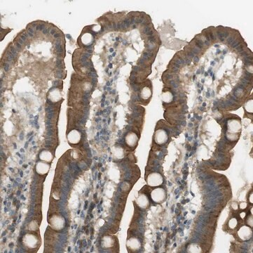 Anti-CLRN3 antibody produced in rabbit, 1 X 100 µL (HPA014482-100UL)