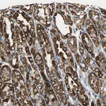 Anti-TMEM120B antibody produced in rabbit, 1 X 100 µL (HPA014066-100UL)
