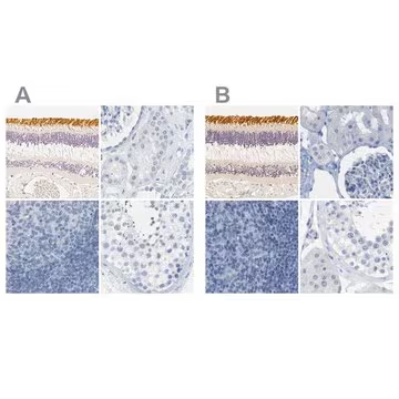 Anti-OPN1SW antibody produced in rabbit, 100 µL (HPA013562-100UL)